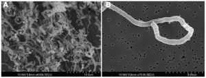 Бактерии Halanaerobium hydrogeninformans</i> (СЭМ). (кликните картинку для увеличения)